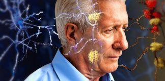 Alzheimer en Menorca